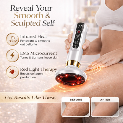 AUREVA™ ThermoSculpt Device